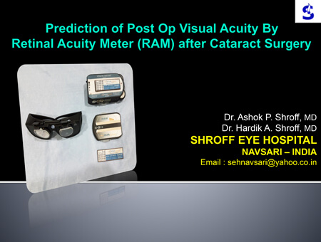 Prediction of Post Op Visual Acuity By Retinal Acuity Meter (RAM) after Cataract Surgery